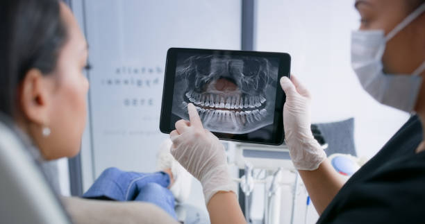 Licensed Wisdom Tooth Removal service in Forestville, MD - Smile Center Dentistry